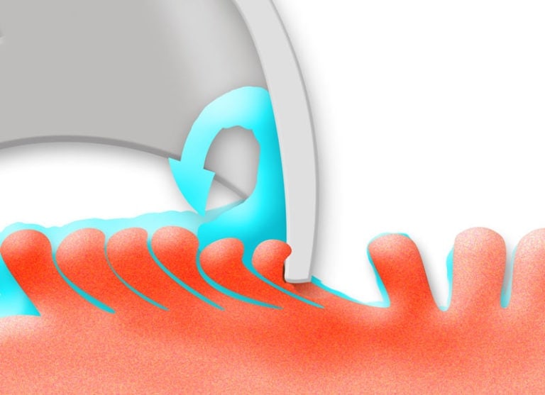 Papillen Zungenschaber Chart 768X557 1